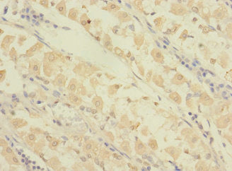 GRAMD1B Antibody