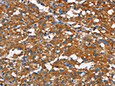 CAMK1D Antibody