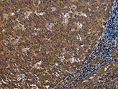FOLH1B Antibody