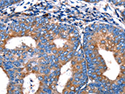 MERTK Antibody