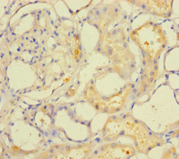 ACOT6 Antibody