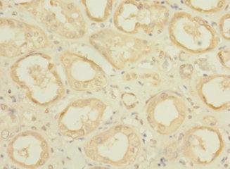 CFAP100 Antibody