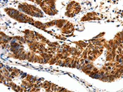SP1 Antibody