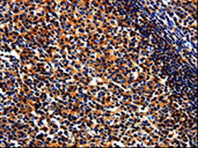 BIRC6 Antibody