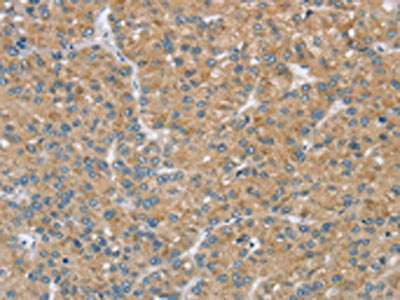SENP3 Antibody