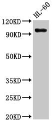 KMT5B Antibody