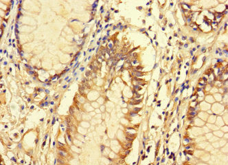 FAM135B Antibody