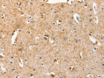 BRCA1 Antibody