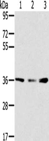 SMN1 Antibody