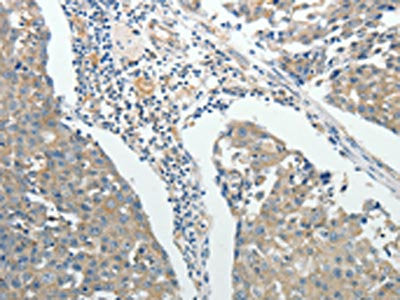ROCK1 Antibody