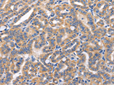 CARD17 Antibody