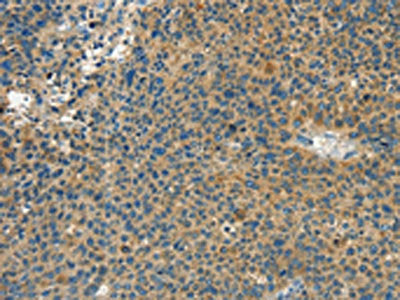 CALCA Antibody