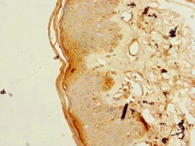 VWA3B Antibody