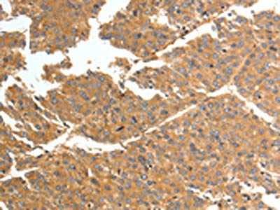 TNN Antibody