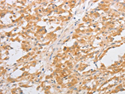 CDKN2AIP Antibody