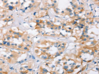 BCAS4 Antibody