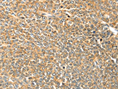 TRPV3 Antibody