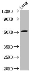 ARHGAP1 Antibody