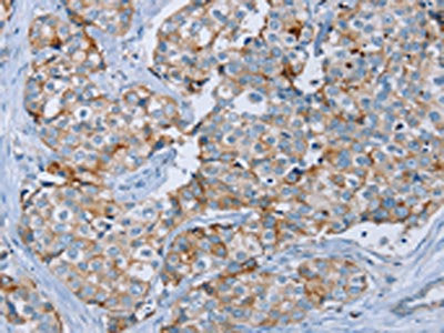 MUC1 Antibody