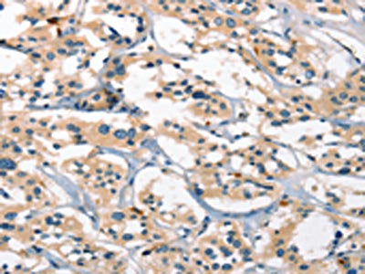 GPR182 Antibody