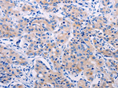 AGT Antibody