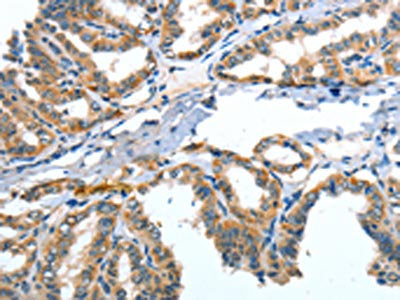 ANGPT2 Antibody