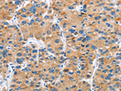 DKK2 Antibody