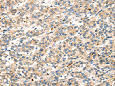 DKK1 Antibody