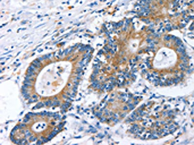 RAF1 Antibody