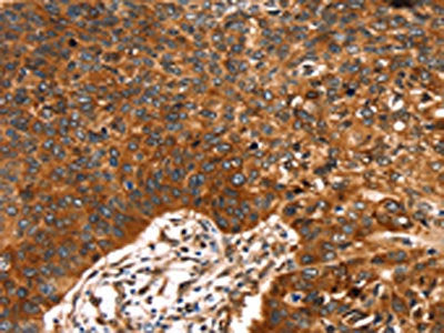 RUNX2 Antibody