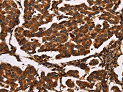 ARSB Antibody