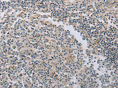 MAGED1 Antibody