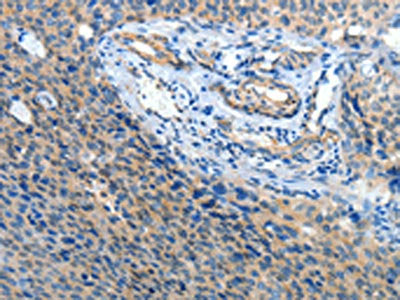 ATP1A1 Antibody