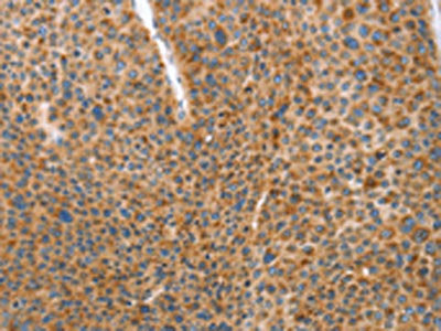 DDX58 Antibody