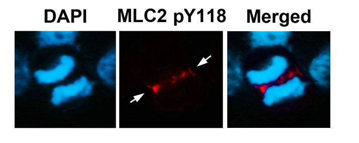 Phospho-MYL9 (Tyr118) Antibody