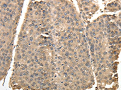 TXN Antibody