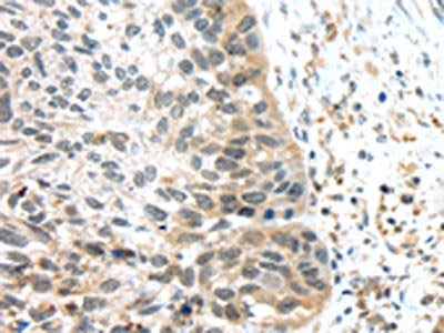 TSPY1/TSPY3 Antibody