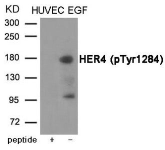 Phospho-ERBB4 (Tyr1284) Antibody