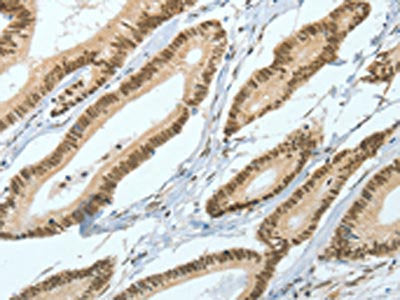 ASH2L Antibody