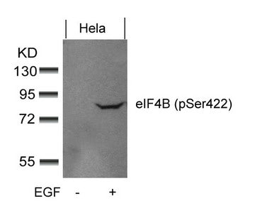 Phospho-EIF4B (Ser422) Antibody