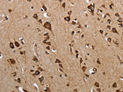 MYH11 Antibody