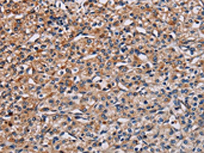 PLCB3 Antibody
