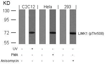 Phospho-LIMK1 (Thr508) Antibody