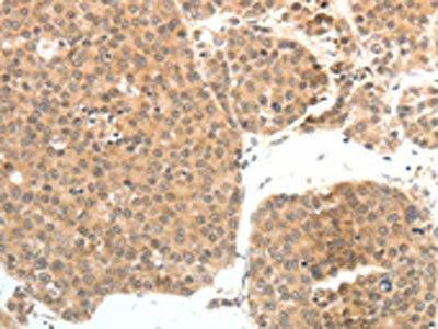 PSMD7 Antibody