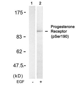 Phospho-PGR (Ser190) Antibody