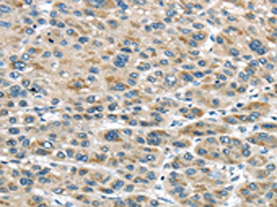 TRAIP Antibody