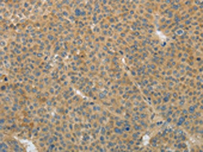 TGFB1 Antibody
