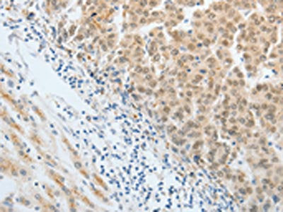 AKAP8L Antibody