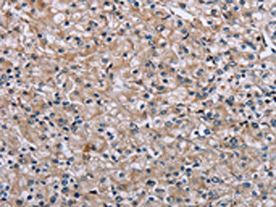 PLCL1 Antibody