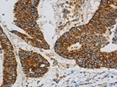 CCNF Antibody